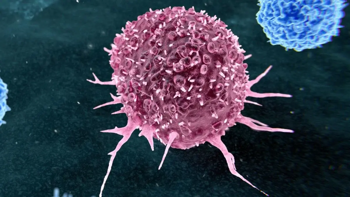 Almost 50% of Preventable Cancers Linked to Just Two Lifestyle Habits